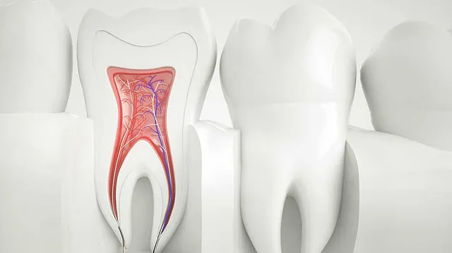 Endodontie (Wurzelbehandulung)